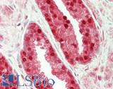 ALOX15B / 15-LOX-2 Antibody - Human Prostate: Formalin-Fixed, Paraffin-Embedded (FFPE)