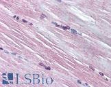 AMPD1 Antibody - Anti-AMPD1 antibody IHC of human skeletal muscle. Immunohistochemistry of formalin-fixed, paraffin-embedded tissue after heat-induced antigen retrieval. Antibody concentration 10 ug/ml.