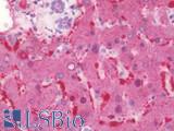 ANGPT1 / Angiopoietin-1 Antibody - Anti-Angiogenin / ANG antibody IHC staining of human liver. Immunohistochemistry of formalin-fixed, paraffin-embedded tissue after heat-induced antigen retrieval. Antibody dilution 1:100.