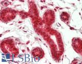 ANKRD30A / NY-BR-1 Antibody - Human Breast: Formalin-Fixed, Paraffin-Embedded (FFPE)