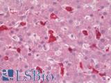 ANKS1B Antibody - Anti-EB-1 / ANKS1B antibody IHC staining of human liver. Immunohistochemistry of formalin-fixed, paraffin-embedded tissue after heat-induced antigen retrieval.