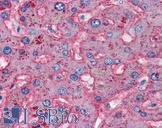 APOB / Apolipoprotein B Antibody - Anti-Apolipoprotein B antibody IHC of human liver. Immunohistochemistry of formalin-fixed, paraffin-embedded tissue after heat-induced antigen retrieval. Antibody concentration 5 ug/ml.