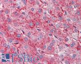APOC3 / Apolipoprotein C III Antibody - Anti-APOC3 / Apolipoprotein CIII antibody IHC of human liver. Immunohistochemistry of formalin-fixed, paraffin-embedded tissue after heat-induced antigen retrieval. Antibody concentration 2.5 ug/ml.