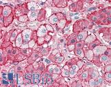 Apolipoprotein A-II Antibody - Anti-APOA2 antibody IHC of human adrenal. Immunohistochemistry of formalin-fixed, paraffin-embedded tissue after heat-induced antigen retrieval. Antibody concentration 5 ug/ml.