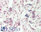 ARHGAP17 / NADRIN Antibody - Human Placenta: Formalin-Fixed, Paraffin-Embedded (FFPE)