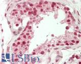 ARID4B Antibody - Human Testis: Formalin-Fixed, Paraffin-Embedded (FFPE)