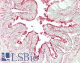 ARL6 Antibody - Human Lung, Respiratory Epithelium: Formalin-Fixed, Paraffin-Embedded (FFPE)