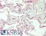 ASAP1 Antibody - Human Lung: Formalin-Fixed, Paraffin-Embedded (FFPE)