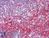 ATG9B Antibody - Anti-ATG9B / APG9L2 antibody IHC of human spleen. Immunohistochemistry of formalin-fixed, paraffin-embedded tissue after heat-induced antigen retrieval. Antibody concentration 5 ug/ml.