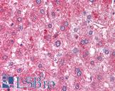 ATM Antibody - Anti-ATM antibody IHC of human liver. Immunohistochemistry of formalin-fixed, paraffin-embedded tissue after heat-induced antigen retrieval. Antibody concentration 2 ug/ml.