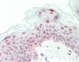 ATMIN Antibody - Human Skin: Formalin-Fixed, Paraffin-Embedded (FFPE)