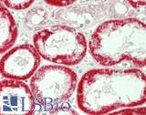 ATP1A1 Antibody - Human Kidney: Formalin-Fixed, Paraffin-Embedded (FFPE)