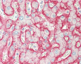 ATP1B1 Antibody - Human Liver: Formalin-Fixed, Paraffin-Embedded (FFPE).  This image was taken for the unconjugated form of this product. Other forms have not been tested.