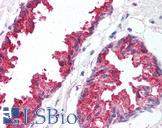 BACE1 / BACE Antibody - Anti-BACE1 antibody IHC of human prostate. Immunohistochemistry of formalin-fixed, paraffin-embedded tissue after heat-induced antigen retrieval.