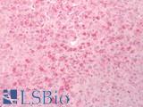 BACE1 / BACE Antibody - Human Liver: Formalin-Fixed, Paraffin-Embedded (FFPE)