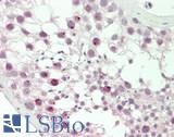 BAF53B / ACTL6B Antibody - Human Testis: Formalin-Fixed, Paraffin-Embedded (FFPE)