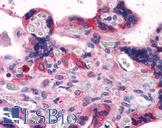 BAG3 / BAG-3 Antibody - Anti-BAG3 antibody IHC of human placenta. Immunohistochemistry of formalin-fixed, paraffin-embedded tissue after heat-induced antigen retrieval. Antibody concentration 3.75 ug/ml.