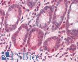 BAZ2B Antibody - Anti-BAZ2B antibody IHC of human small intestine. Immunohistochemistry of formalin-fixed, paraffin-embedded tissue after heat-induced antigen retrieval. Antibody concentration 5 ug/ml.