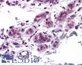 BCAS3 Antibody - Anti-BCAS3 antibody IHC of human breast. Immunohistochemistry of formalin-fixed, paraffin-embedded tissue after heat-induced antigen retrieval. Antibody concentration 5 ug/ml.