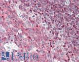 BCL11A Antibody - Human Tonsil: Formalin-Fixed, Paraffin-Embedded (FFPE)