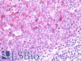 BCL2L11 / BIM Antibody - Anti-BCL2L11 / BIM antibody IHC staining of human tonsil. Immunohistochemistry of formalin-fixed, paraffin-embedded tissue after heat-induced antigen retrieval. Antibody dilution 1:50.
