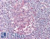 BCL6 Antibody - Human Tonsil: Formalin-Fixed, Paraffin-Embedded (FFPE)