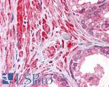 BIRC2 / cIAP1 Antibody - Anti-cIAP1 antibody IHC of human prostate. Immunohistochemistry of formalin-fixed, paraffin-embedded tissue after heat-induced antigen retrieval. Antibody dilution 1:250.