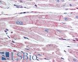 BIRC7 / Livin Antibody - Anti-BIRC7 / Livin antibody IHC of human heart. Immunohistochemistry of formalin-fixed, paraffin-embedded tissue after heat-induced antigen retrieval. Antibody concentration 10 ug/ml.