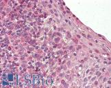 BLIMP1 / PRDM1 Antibody - Anti-BLIMP1 / PRDM1 antibody IHC of human tonsil. Immunohistochemistry of formalin-fixed, paraffin-embedded tissue after heat-induced antigen retrieval. Antibody dilution 3.75 ug/ml.