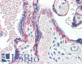 BOD1 Antibody - Anti-BOD1 antibody IHC staining of human placenta. Immunohistochemistry of formalin-fixed, paraffin-embedded tissue after heat-induced antigen retrieval. Antibody concentration 10 ug/ml.