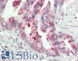 BPIFB1 Antibody - Human Lung, Respiratory Epithelium: Formalin-Fixed, Paraffin-Embedded (FFPE)