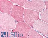 BRCC3 / BRCC36 Antibody - Anti-BRCC3 / BRCC36 antibody IHC of human skeletal muscle. Immunohistochemistry of formalin-fixed, paraffin-embedded tissue after heat-induced antigen retrieval. Antibody concentration 5 ug/ml.