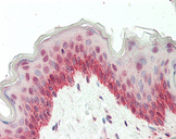 BRD9 Antibody - Human Skin: Formalin-Fixed, Paraffin-Embedded (FFPE)