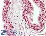 BRF1 Antibody - Human Prostate: Formalin-Fixed, Paraffin-Embedded (FFPE)