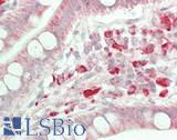 C1orf151 Antibody - Human Small Intestine: Formalin-Fixed, Paraffin-Embedded (FFPE)