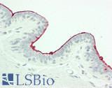 CA 15-3 Antibody - Human Breast: Formalin-Fixed, Paraffin-Embedded (FFPE)