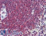 CA1 / Carbonic Anhydrase I Antibody - Anti-CA1 / Carbonic Anhydrase I antibody IHC of human spleen. Immunohistochemistry of formalin-fixed, paraffin-embedded tissue after heat-induced antigen retrieval. Antibody concentration 2.5 ug/ml.