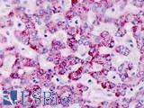 CAPNS2 Antibody - Human, Liver: Formalin-Fixed Paraffin-Embedded (FFPE)