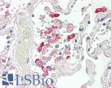 Carboxylesterase 1 / CES1 Antibody - Anti-CES1 antibody IHC of human lung. Immunohistochemistry of formalin-fixed, paraffin-embedded tissue after heat-induced antigen retrieval. Antibody concentration 5 ug/ml.