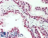 CASC4 Antibody - Anti-CASC4 antibody IHC staining of human prostate. Immunohistochemistry of formalin-fixed, paraffin-embedded tissue after heat-induced antigen retrieval.