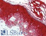 CASP14 / Caspase 14 Antibody - Anti-Caspase 14 antibody IHC of human skin. Immunohistochemistry of formalin-fixed, paraffin-embedded tissue after heat-induced antigen retrieval. Antibody concentration 5 ug/ml.