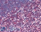 CASP8 / Caspase 8 Antibody - Anti-Caspase 8 antibody IHC of human thymus. Immunohistochemistry of formalin-fixed, paraffin-embedded tissue after heat-induced antigen retrieval. Antibody concentration 5 ug/ml.