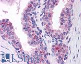 CASP9 / Caspase 9 Antibody - Anti-Caspase 9 antibody IHC of human prostate. Immunohistochemistry of formalin-fixed, paraffin-embedded tissue after heat-induced antigen retrieval. Antibody dilution 1:50.