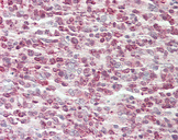 CBFA2T2 / MTGR1 Antibody - Human Tonsil: Formalin-Fixed, Paraffin-Embedded (FFPE).  This image was taken for the unconjugated form of this product. Other forms have not been tested.