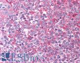 CCL7 / MCP3 Antibody - Anti-CCL7 / MCP3 antibody IHC of human tonsil. Immunohistochemistry of formalin-fixed, paraffin-embedded tissue after heat-induced antigen retrieval. Antibody concentration 5 ug/ml.  This image was taken for the unconjugated form of this product. Other forms have not been tested.