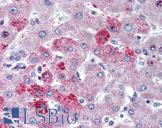 CCR10 / GPR2 Antibody - Anti-CCR10 antibody IHC of human liver. Immunohistochemistry of formalin-fixed, paraffin-embedded tissue after heat-induced antigen retrieval. Antibody concentration 5 ug/ml.