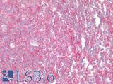 CCR6 Antibody - Human Tonsil: Formalin-Fixed, Paraffin-Embedded (FFPE)