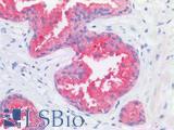 CD177 Antibody - Human Prostate: Formalin-Fixed, Paraffin-Embedded (FFPE)