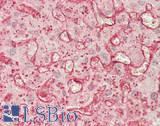 CD209 / DC-SIGN Antibody - Human Liver: Formalin-Fixed, Paraffin-Embedded (FFPE)