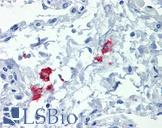 CD209 / DC-SIGN Antibody - Anti-CD209 / DC-SIGN antibody IHC of human lung. Immunohistochemistry of formalin-fixed, paraffin-embedded tissue after heat-induced antigen retrieval. Antibody concentration 20 ug/ml.